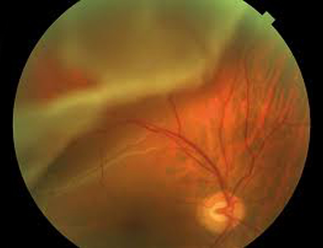 imgexample-retina-2