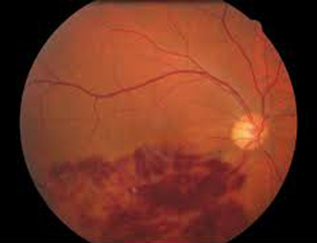 imgexample-retina-3