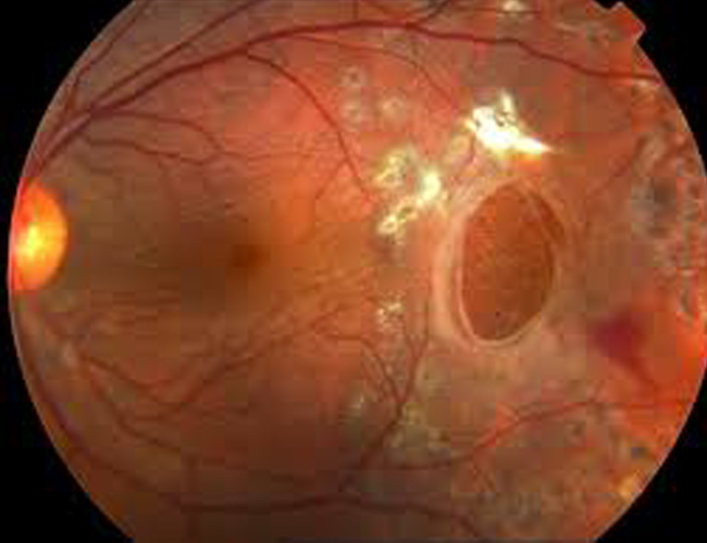 imgexample-retina-4